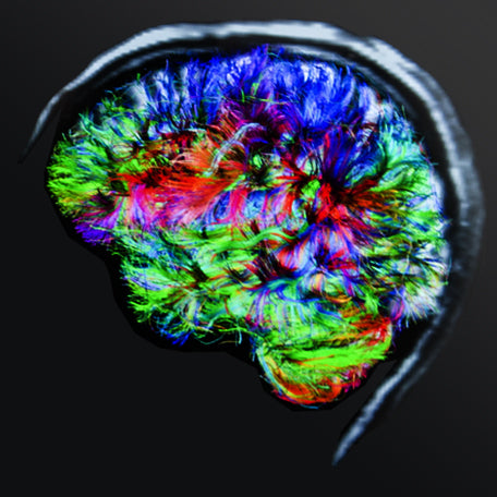 Brain Health
