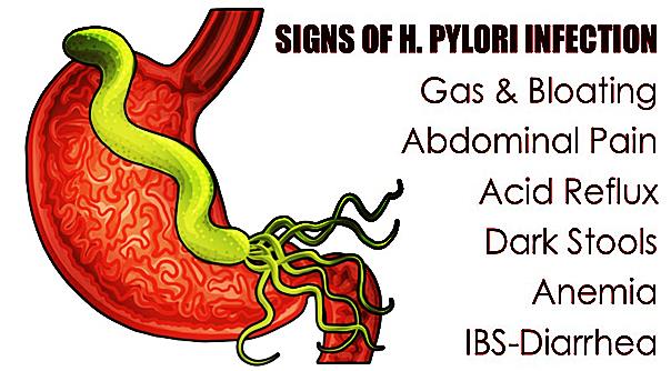 Case Study: Using Frequency To Treat H. Pylori Infection