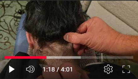 Suboccipital Release for Chronic Headaches & Migraines | Dr. Lorn Allison Demonstration
